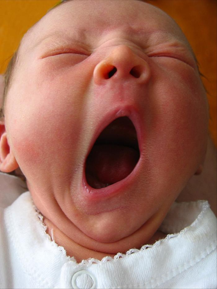 Why Yawning Is Contagious.
